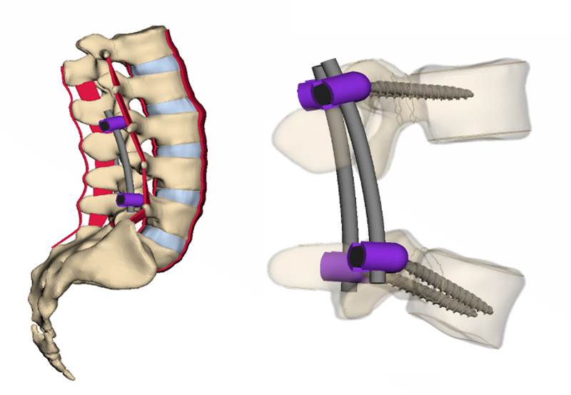 Medical Devices and Instrumentation