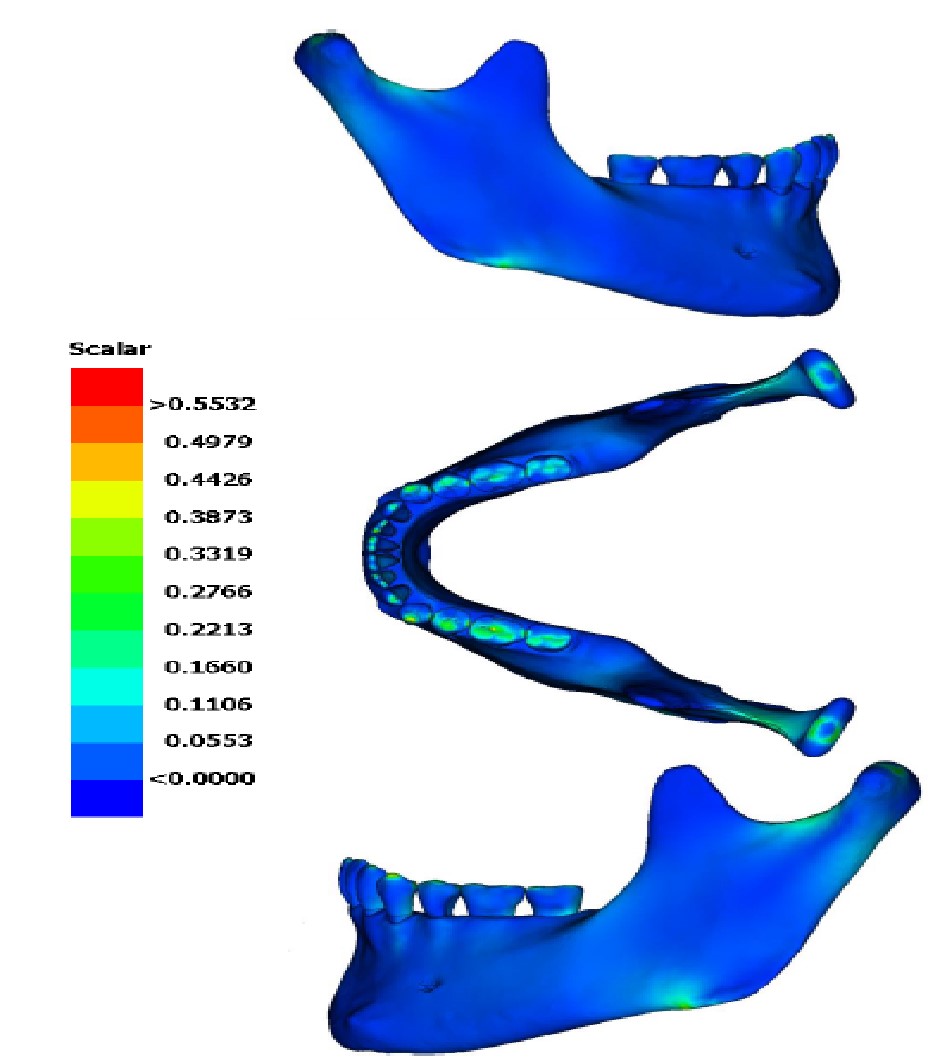 Analytical determination of the dynamic masticatory forces in the human mandible_2.jpg