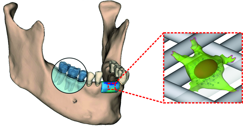 Tissue_engineering